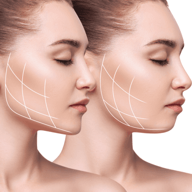 Contorno facial